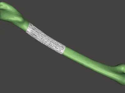 Bone with lattice 3D print model