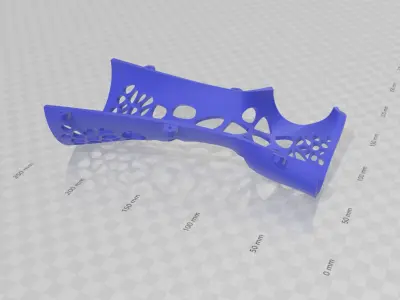 ARM SPLINT - 3D PRINT 3D print model