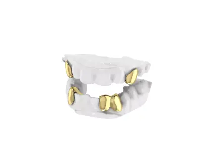 Gold Grillz  3D print model