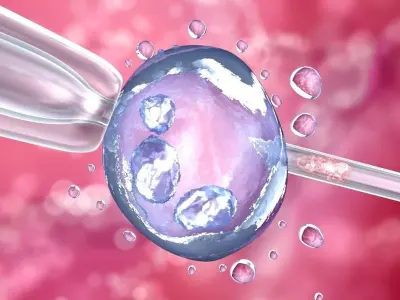  Artificial insemination - glass needle fertilizing a female egg 3D model