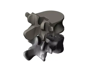 Spinal vertebrae 3D print model