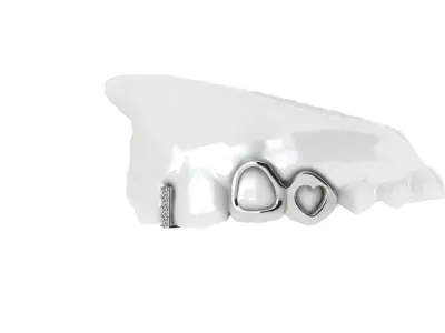 Grillz -gold -diamonds 3D print model