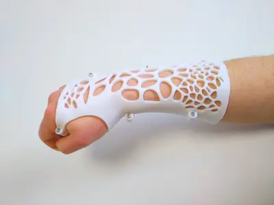 ARM SPLINT - 3D PRINT 3D print model