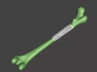Bone with lattice 3D print model