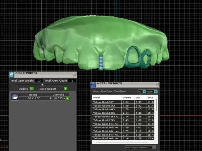 Grillz -gold -diamonds 3D print model
