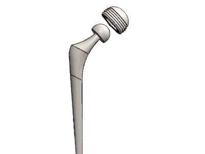 hip-femur joint cad 3D print model