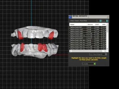 Gold Grillz  3D print model