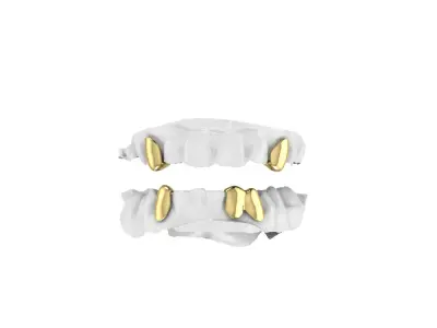Gold Grillz  3D print model