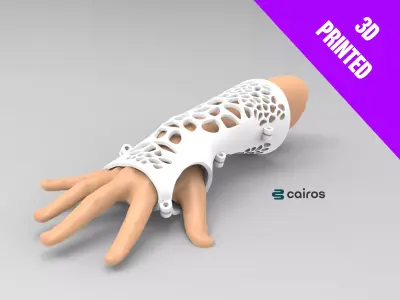 ARM SPLINT - 3D PRINT 3D print model