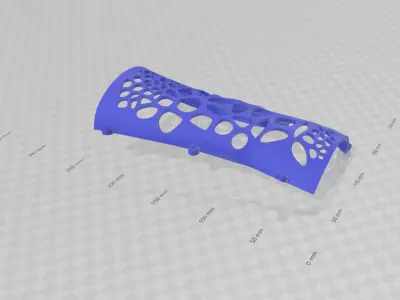 ARM SPLINT - 3D PRINT 3D print model