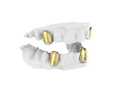 Gold Grillz  3D print model