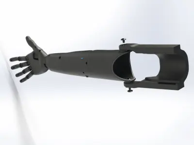 prosthesis arm 3D print model