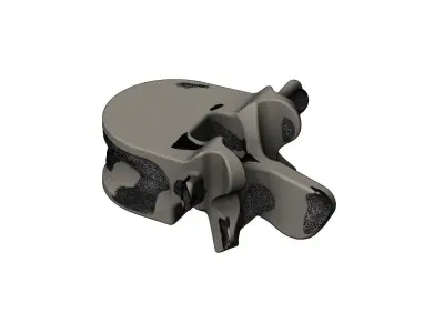 Spinal vertebrae 3D print model