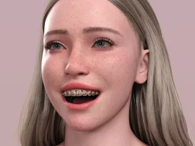 HX Braces for Genesis 9