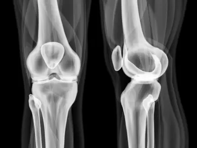  anatomically correct knee 