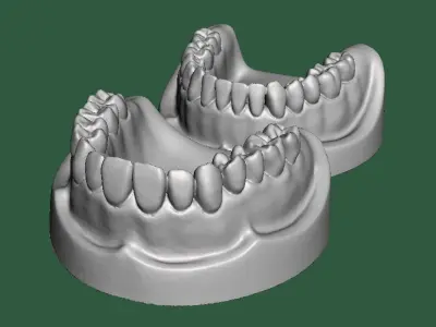D0015 Dental model upper and lower solid model for test print Free 3D print model