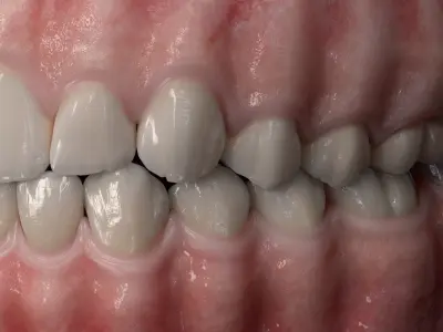  Realistic Dental Model With Gums Teeth and Tongue 
