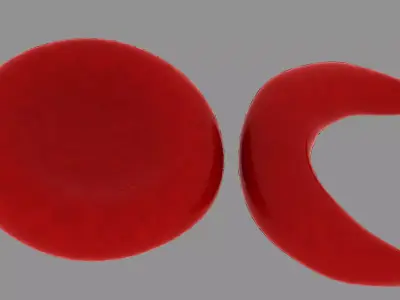 Red blood cell and sickle blood cell Low-poly 3D model