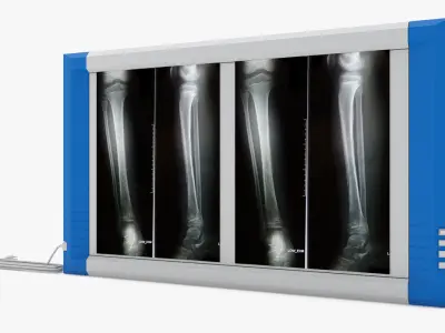 Medical - XRay Light Box  3D model
