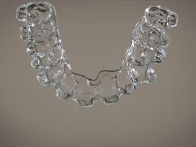 Digital Orthodontic Indirect Bonding Tray 3D print model