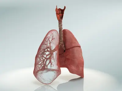  Lungs with bronchial tree 