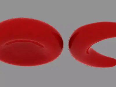 Red blood cell and sickle blood cell Low-poly 3D model