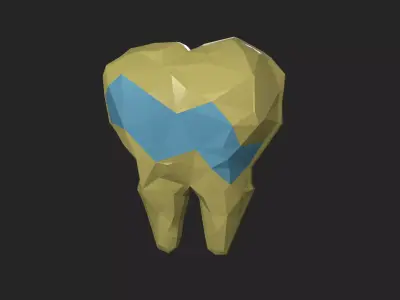 Tooth 3D printing ready Model for dental chamber 3D print model