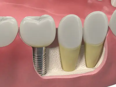  Dental Collection 4 