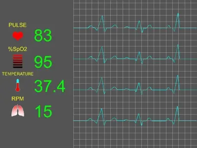 Vital functions monitor 3D model