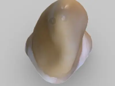 White Spot Lesions Low-poly 3D model