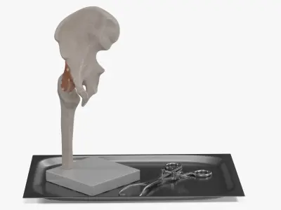 Anatomical Model of Hip Joint with Bone Holder Ollier 