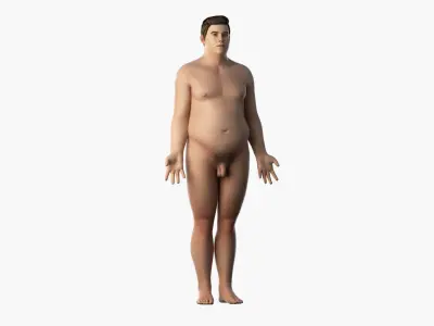  Full Obese Male Anatomy 