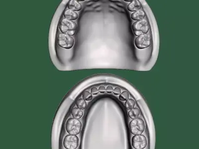 D0015 Dental model upper and lower solid model for test print Free 3D print model