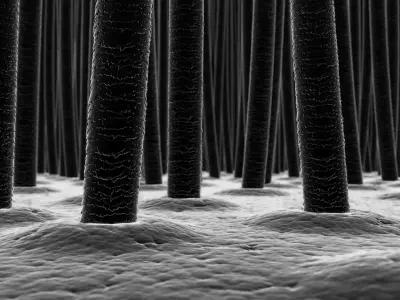 Scalp and Hair Closeup X-Ray 3D model