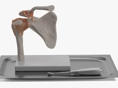  Anatomical Model of Shoulder Joint with Volkmann Bone Curette 