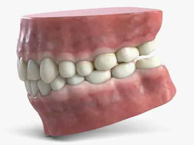  Human Teeth and Gum 