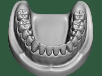 D0015 Dental model upper and lower solid model for test print Free 3D print model