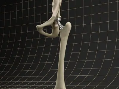 Femoral prosthesis femur and pelvic gilder  3D model