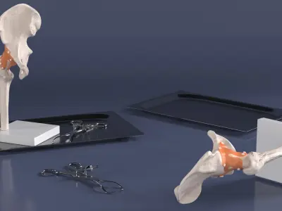  Anatomical Model of Hip Joint with Bone Holder Ollier 