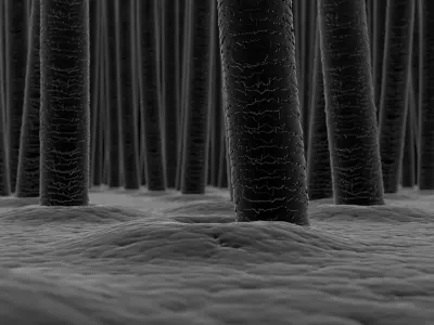 Scalp and Hair Closeup X-Ray 3D model