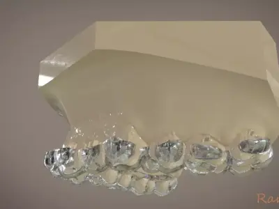 Digital Orthodontic Indirect Bonding Tray 3D print model