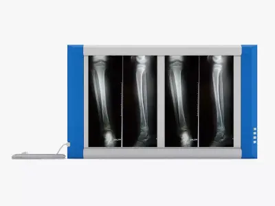 Medical - XRay Light Box  3D model