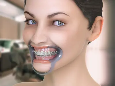  Orthodontic Mannequin 