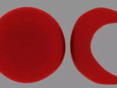Red blood cell and sickle blood cell Low-poly 3D model