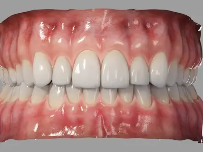  Realistic Rigged Vampire Teeth Mouth 