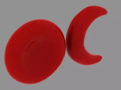 Red blood cell and sickle blood cell Low-poly 3D model