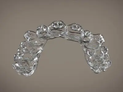 Digital Orthodontic Indirect Bonding Tray 3D print model