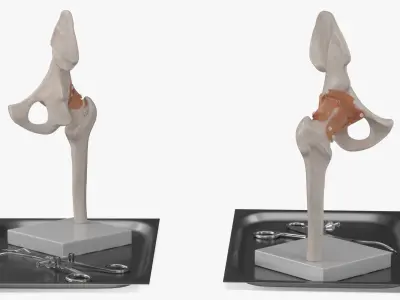  Anatomical Model of Hip Joint with Bone Holder Ollier 