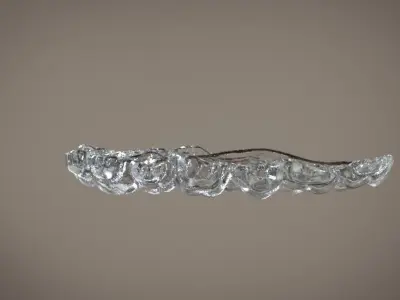 Digital Orthodontic Indirect Bonding Tray 3D print model