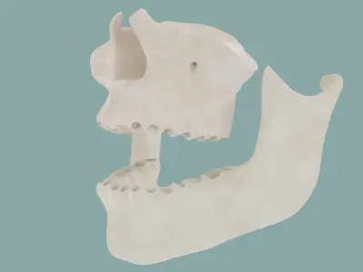  Teeth Gums and Bones 